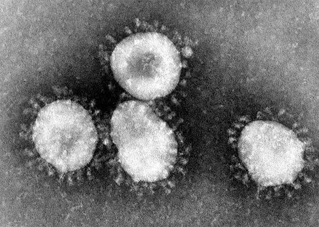 An example of a coronavirus.