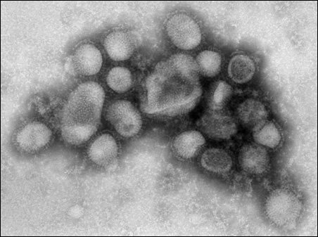H1N1 virus