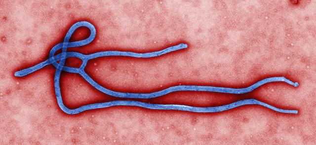 Ebola virus virion  CDC/Cynthia Goldsmith
